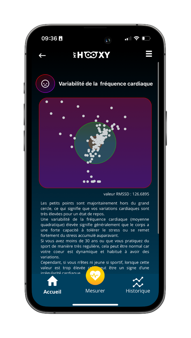 La variabilité de la fréquence cardiaque - Sensoria Analytics